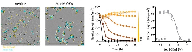 Neuronal and Microglial Analysis for Alzheimer’s Disease Models