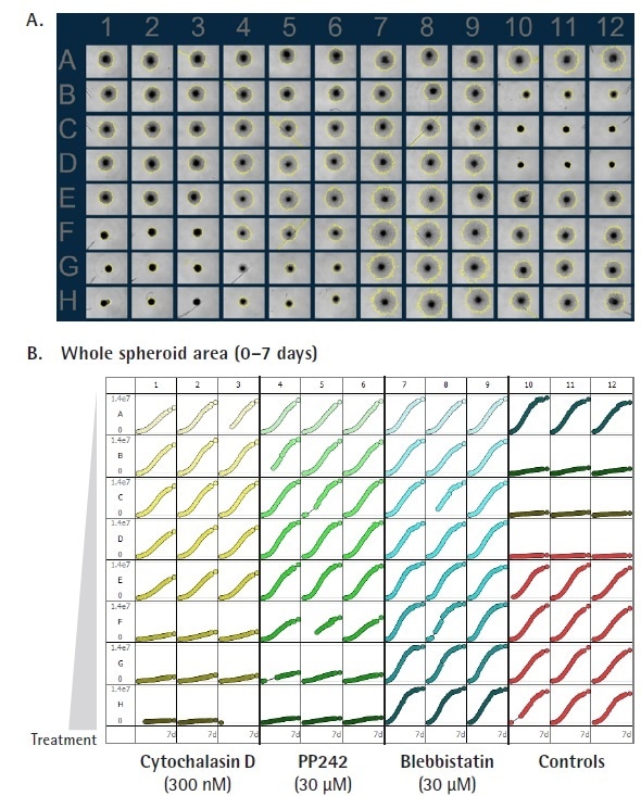 Effect of cell signalling inhibitors on spheroid invasion. U87-MG cells were seeded in a ULA round bottom 96-well plate (2,500 cells/well) and allowed to form spheroids (3 d) prior to treatment with a range of known inhibitors and embedded in Matrigel (4.5 mg/mL). IncuCyte brightfield (BF) images (A) (4 d post treatment) show treatment effects on spheroid invasion. Bar chart (B) represents the area under the curve (AUC) analysis of the whole spheroid and invading cell area (μm2) time-course data (0 -162 h, post treatment). Note the inhibitory and stimulatory effects on invasion caused by Cytochalasin D (Cyto D) and Blebbistatin respectively. Data normalization (96 h post treatment) show effect of Cyto D and PP242 on invading cell regions (C). Subtraction of invading cell area from whole spheroid area (D). In a separate but identical study performed in the absence of Matrigel shows size (BF area) of spheroids 96 h post treatment with Cyto D and PP242 (D). Data were collected over a 162 h period at 6 h intervals. All images captured at 4x magnification. Each data point represents mean ± SEM,