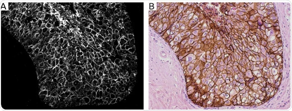 New method for digital tissue diagnostics can streamline diagnosis and improve accuracy