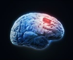 Researches implant ultrathin, flexible brain interfaces with long lifetimes