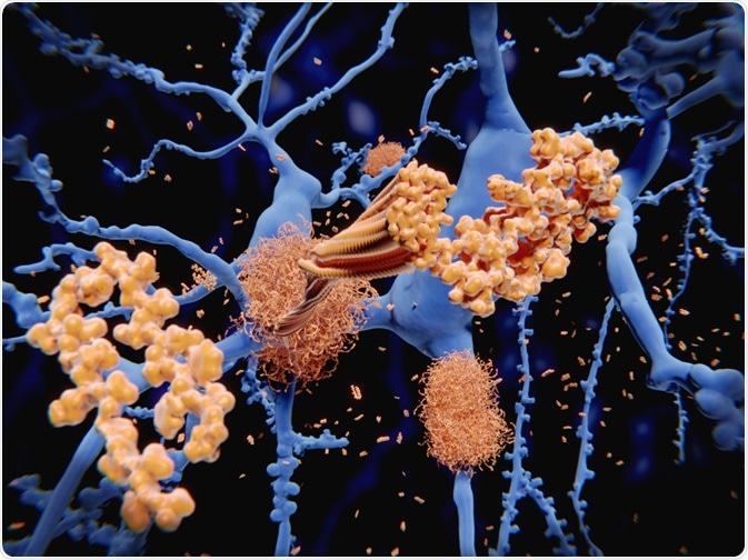 Amyloid-Beta Peptide