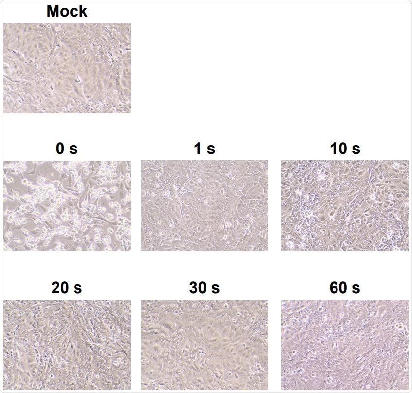 Cytopathic changes in virus-infected Vero cells without DUV-LED irradiation (0 s), or with 122 DUV-LED irradiation for 1, 10, 20, 30 or 60 s.