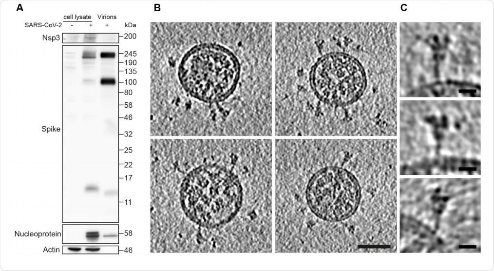 Characterization of virus production and representative images of intact, authentic SARSCoV-2 virions. (A) Western blot analysis of SARS-CoV-2 S and N in lysates of VeroE6 cells and in virus preparations. In released virions, S is present in both cleaved and uncleaved forms. (B) Four representative tomographic slices of SARS-CoV-2 virions from the supernatant of infected cells. Virions are approximately spherical, contain granular density corresponding to N-packaged genome, and have S protein trimers protruding at variable angles from their surfaces. Scale bar 50 nm. (C) Three example S trimers from the dataset shown as projections through the trimer to illustrate the variable tilt towards the membrane. Scale bar 10 nm.