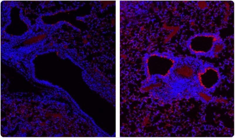 A protein that helps treat viruses can later interfere with lung tissue repair