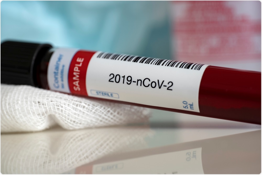 Study: Relationship Between Blood Group and Risk of Infection and Death in COVID-19: a live Meta-Analysis. Image Credit: Myriam B / Shutterstock