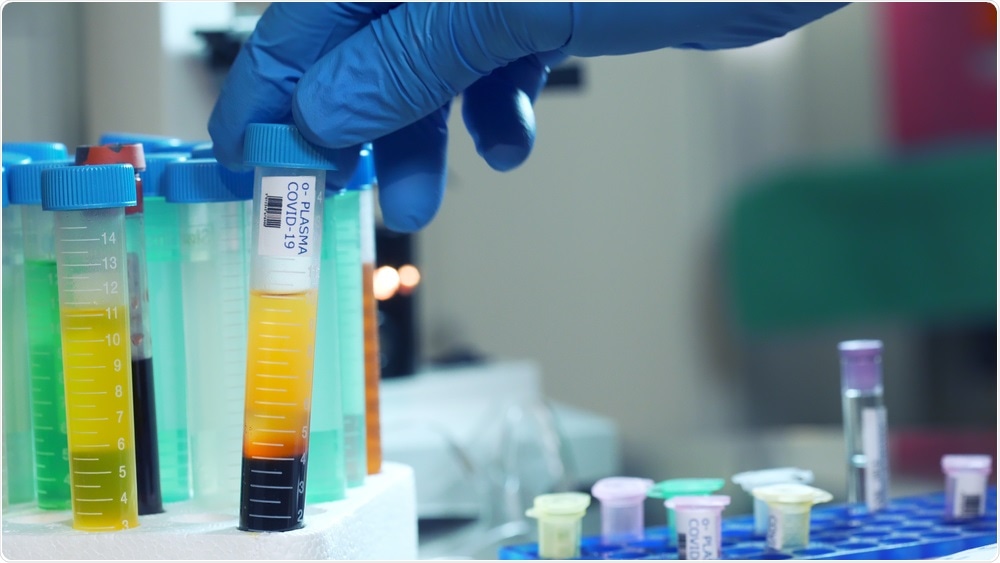 Vial containing blood plasma from a COVID-19 patient. Image Credit: JHDT Productions