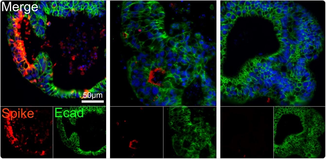 Human intestinal organoids derived from pluripotent stem cells (PSC-HIOs) express ACE2 and TMPRSS2 and support SARS-CoV-2 infection which is inhibited by remdesivir. Remdesivir treatment decreases SARS-CoV-2 infection of PSC-HIOs as shown by viral Spike protein staining 48 h post infection. Quantification of infected, spike protein positive cells (mean ±SEM).