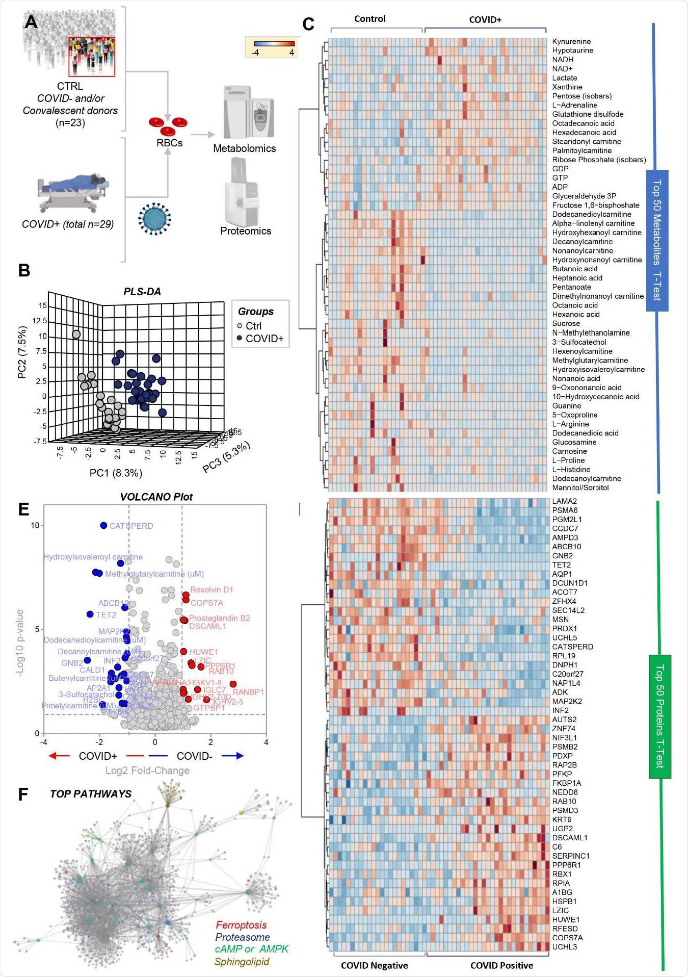 RBC metabolism and proteome are influenced by COVID-19. Metabolomics and proteomics analyses were performed on RBCs from COVID-19-negative (n=23) and -positive (n=29) subjects, as determined by molecular testing of nasopharyngeal swabs (A). The effects of COVID-19 on RBCs, as gleaned by PLS-DA (B) and hierarchical clustering analysis of the top 50 metabolites (C) and proteins (D) by t-test. In E, the volcano plot highlights the significant metabolites and proteins increasing (red) or decreasing (blue) in RBCs from COVID-19 patients, as compared to non-infected controls. In F, pathway analyses were performed on the significant features from the analyses in B-E.