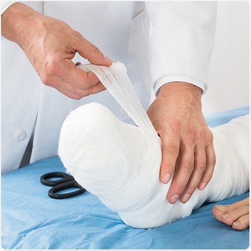 Novel plasma-coated bandages could revolutionize the treatment of chronic wounds Novel plasma-coated bandages could revolutionize the treatment of chronic wounds