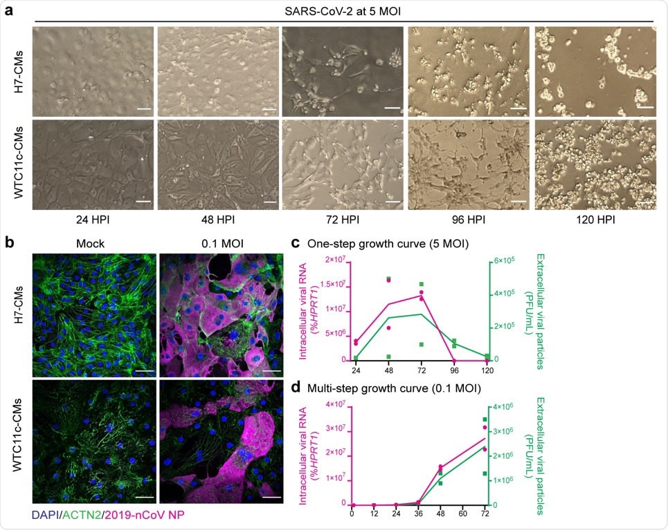 hPSC-CMs are permissive to SARS-CoV-2 infection and replication. (a) Cytopathic effects of SARS-CoV-2 at 5 MOI in H7 hESC-CMs and WTC11c hiPSC-CMs during a time course of 120 h. Scale bars: 100 μm. (b) Immunofluorescent staining of H7 hESC-CMs and WTC11c hiPSC-CMs at 48 HPI with SARS-CoV-2 dose of 0.1 MOI. Scale bars: 50 μm. Individual channels are shown in Supplementary Fig. 2c. (c) One-step viral growth curve in H7 hESC-CMs infected with SARS-CoV-2 at 5 MOI over a time course of 120 h. (d) Multi-step viral growth curve in H7 hESC-CMs infected with SARS-CoV-2 at 0.1 MOI over a time course of 72 h. For both c and d, lines connect the means of two independent experiments. Viral RNA indicating intracellular viral replication is plotted on the left y axis as % of HPRT1. Viral particles secreted in the supernatant are plotted on the right y axis as PFU/mL.