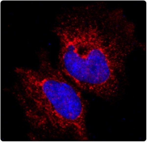 Research identifies protein molecule that could be responsible for aggressive breast cancers