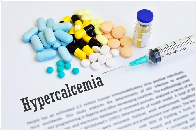 Hypercalcemia