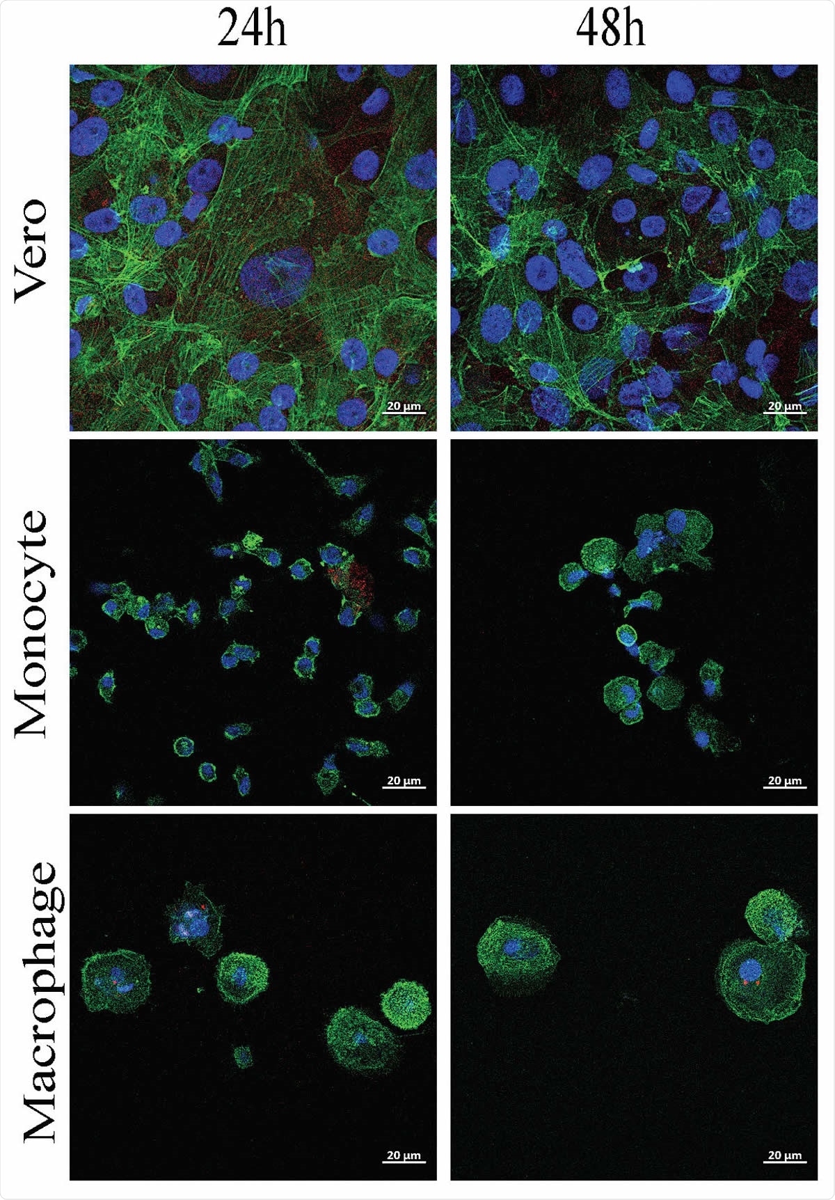 SARS-CoV-2 infects monocytes and macrophages and stimulates cytokine release. Vero E6 cells, monocytes and monocyte-derived macrophages were infected with SARS-CoV-2 IHU-MI3 strain (0.1 MOI) for 24 or 48 hours. (A) SARS-CoV-2 quantification was evaluated by RT-PCR, expressed as Ct values and observed in red in infected cells, with the nucleus in blue and F-actin in green (n = 3). Pictures were acquired using a confocal microscope (63x). ****P < 0.0001 using two-way ANOVA and Turkey’s test for post-hoc comparisons.