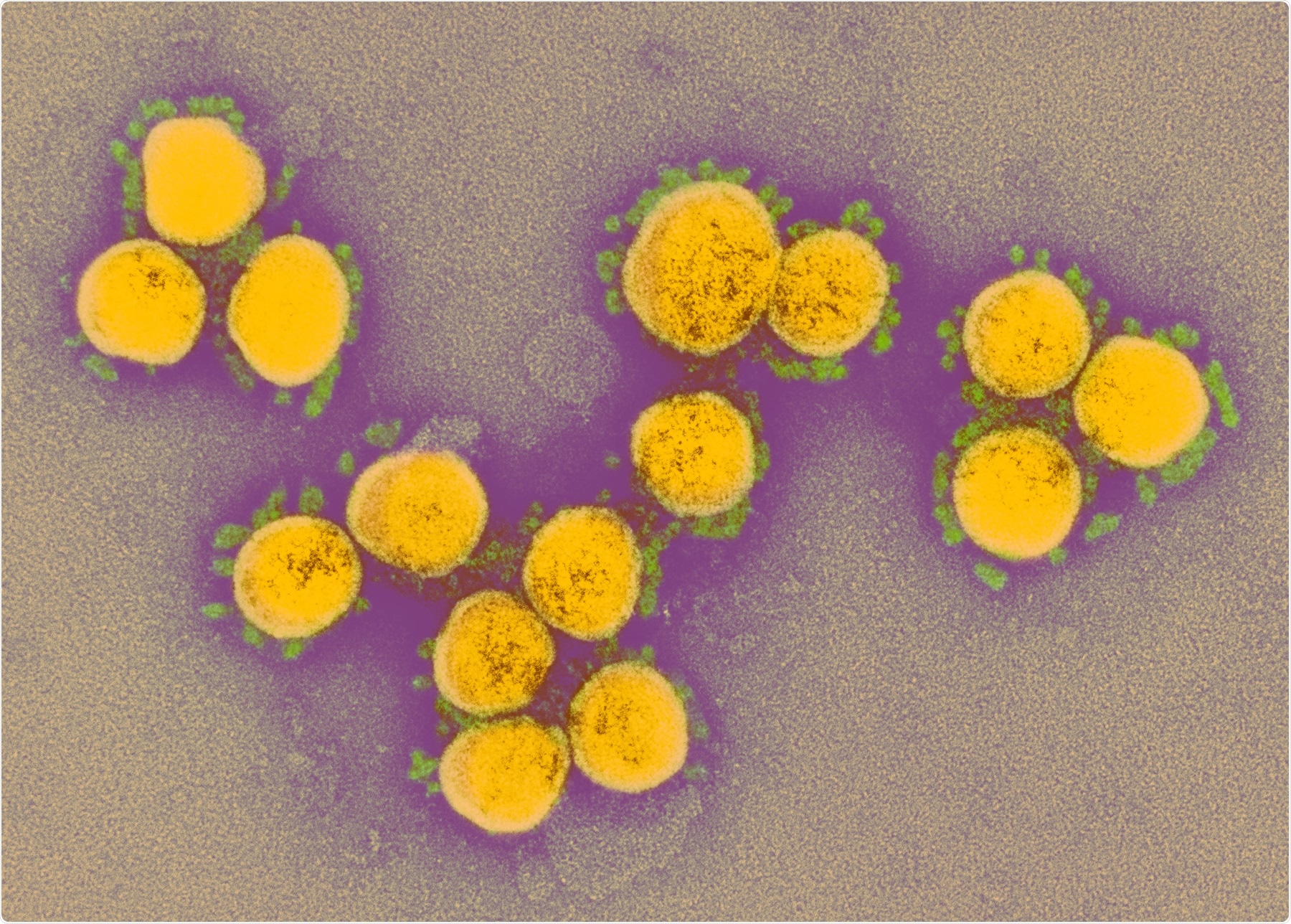 Study: Dismantling myths on the airborne transmission of severe acute respiratory syndrome coronavirus (SARS-CoV-2). Image Credit: NIAID