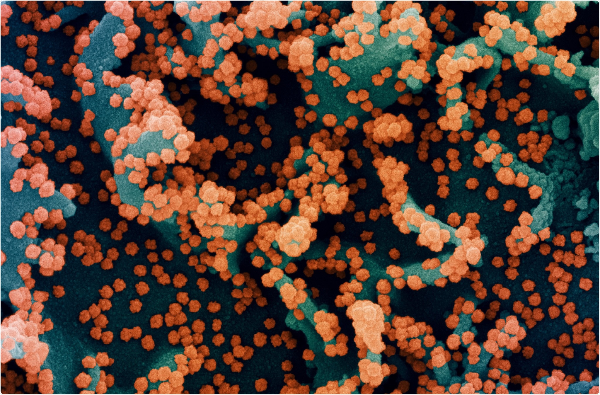 Study: The impact of Spike mutations on SARS-CoV-2 neutralization. Image Credit: NIAID