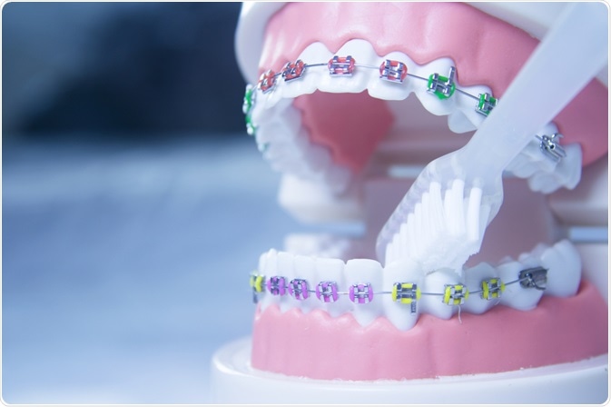 orthodontics