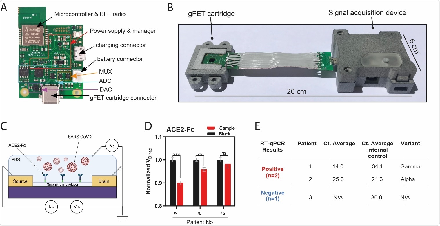 Point-of-Care (POC) device detects SARS-CoV-2 in patient samples (A) Signal acquisition module of the POC device with main elements labelled. (B) Photograph of the gFET Cartridge Unit and the Signal acquisition modules connected together to form the entire POC. A reference dimension bar is reported below. (C) Schematic representation of gFET modified with ACE2-Fc tested on viral samples from patients. (D) Bar graph reporting ACE2-Fc_gFET signal before (black) and after the addition of swab specimens (red) from patient 1, 2 and 3. **P<.01, ***P<.001; (E) RT-qPCR results for the detection of the SARS-CoV-2 specific genes (E gene; RdRP gene; S gene and ORF1ab gene) of the three patient samples. Ct value in clinical samples were evaluated. Ct average value of internal control are indicated for each sample. The type of virus variant (as detected by targeted RT-PCR) is also reported.