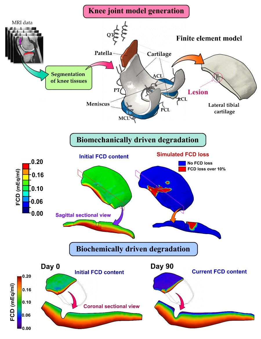 Researchers capture mechanisms for predicting cartilage degradation and recovery after ACL injury