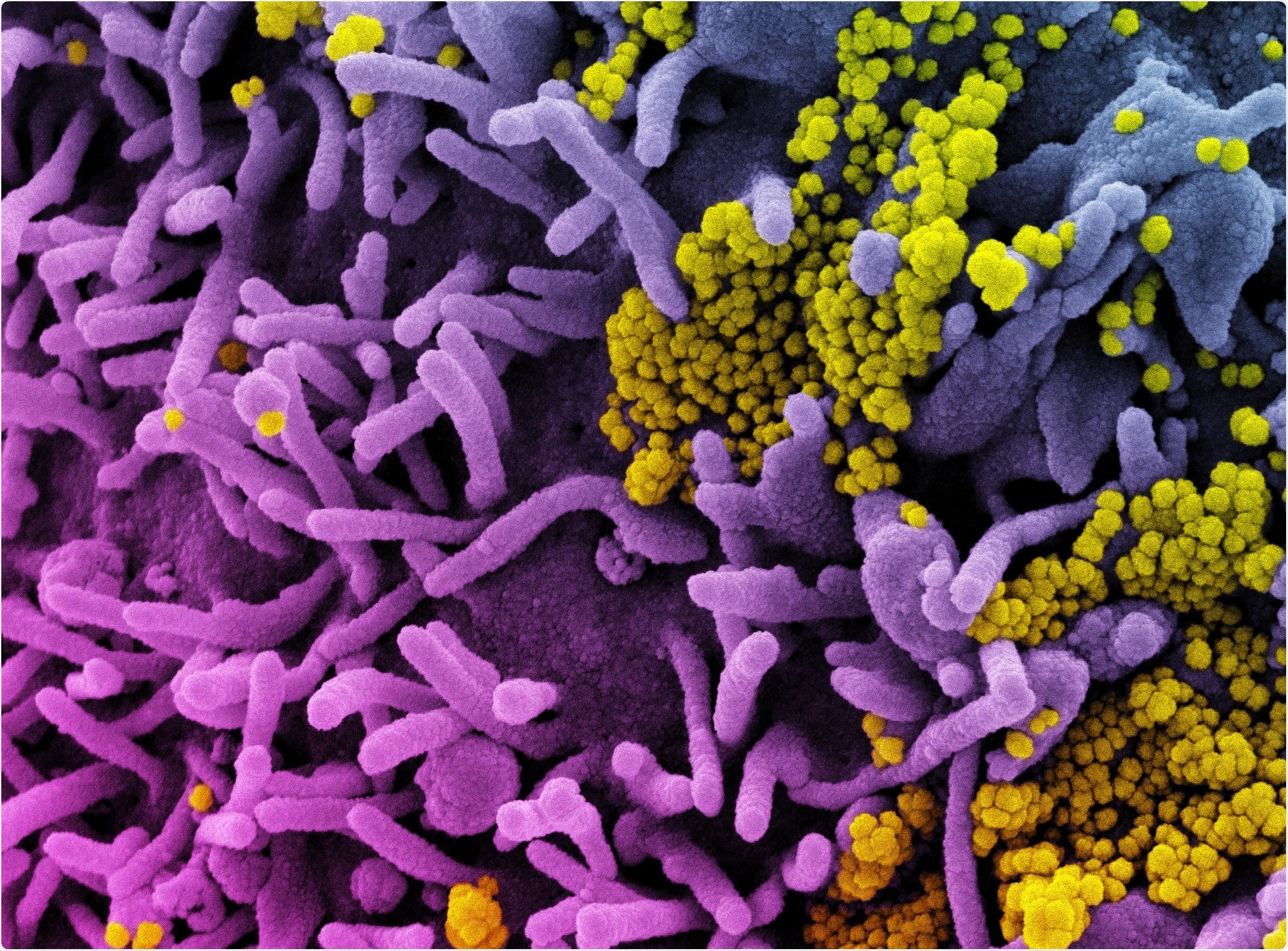 Study: SARS-CoV-2 Delta vaccine breakthrough transmissibility in Alachua, Florida. Image Credit: NIAID