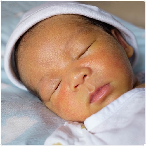 New imaging software can accurately diagnose jaundice in the blink of an eye