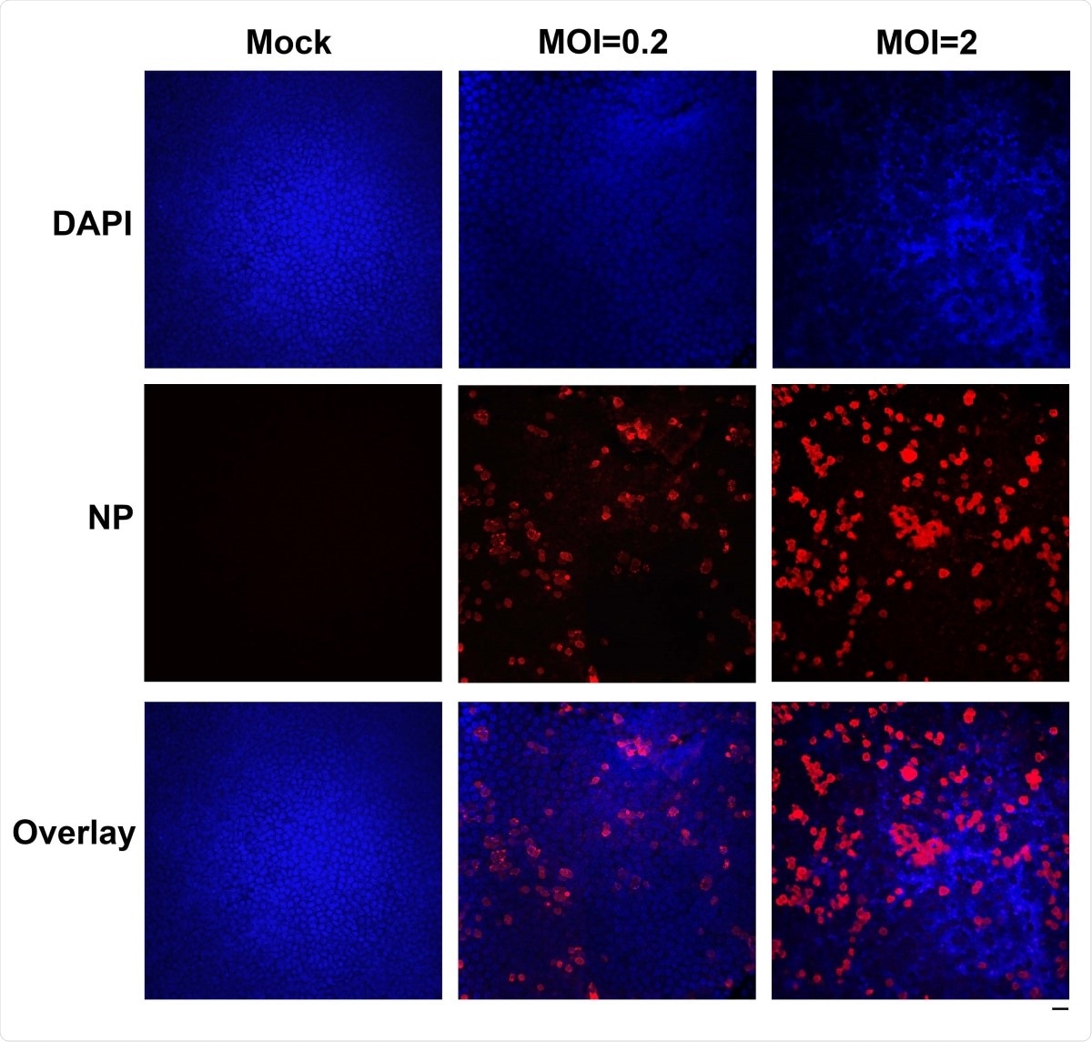 Immunofluorescence analysis of SARS-CoV-2 infection of HAE cells. HAE-ALIB2-20 cultures were infected with SARS-CoV-2 at an MOI of 0.2 or 2 pfu/cell, as indicated, mock-infected (Mock). At 4 days post-infection, a piece of the insert membrane was fixed in 4% paraformaldehyde in PBS at 4°C overnight. and subjected to direct  immunofluorescence analysis. The membranes were stained with anti-SARS-CoV-2 N protein (NP). Images were taken on a Leica TCS SPE confocal microscope under 40×, which was controlled by Leica Application Suite X software. The nuclei were stained with DAPI (4’=,6- diamidino-2-phenylindole). Scale bar is 20 µM.