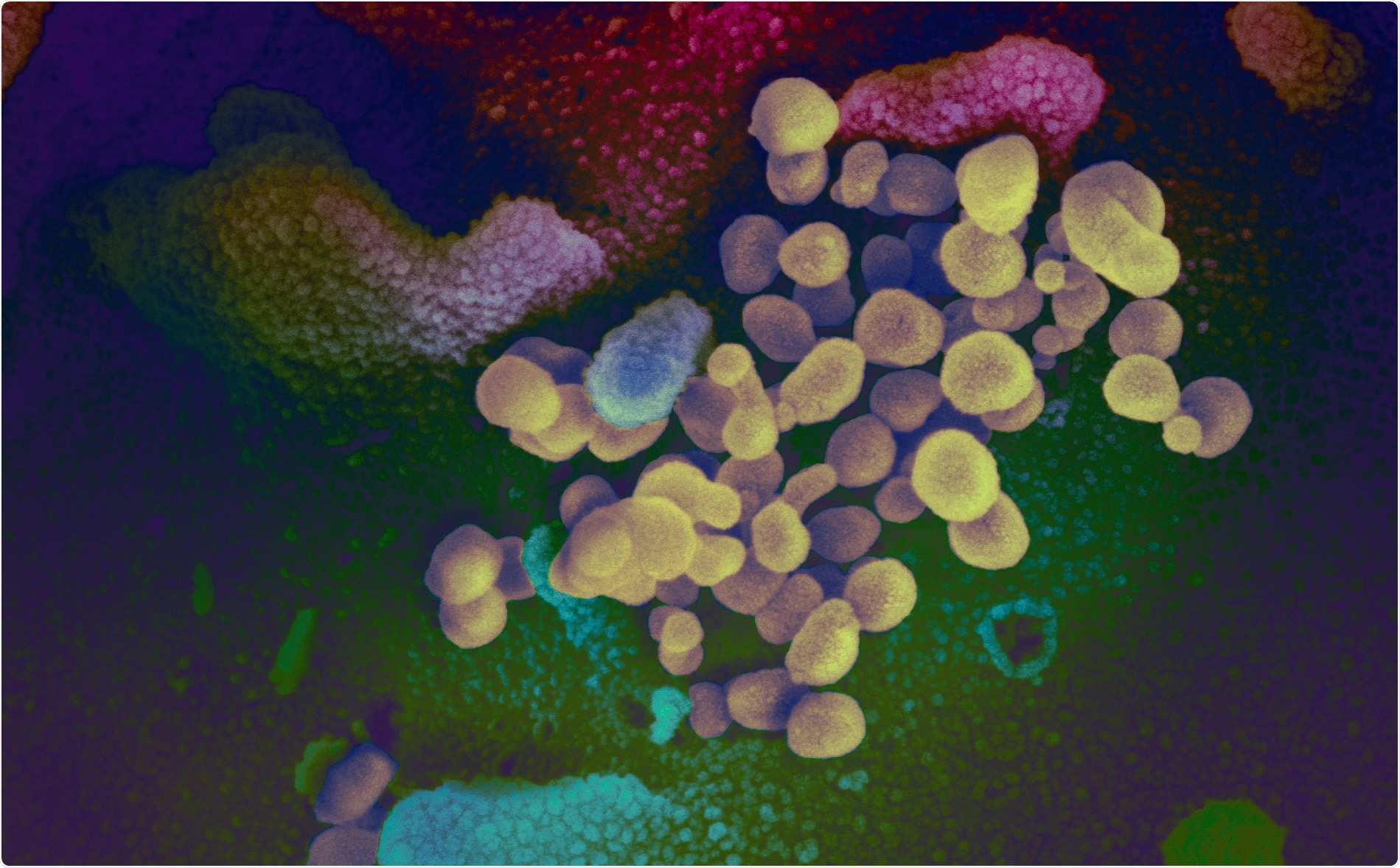 Study: Impact of the B.1.1.7 variant on neutralizing monoclonal antibodies recognizing diverse epitopes on SARS-CoV-2 Spike. Image Credit: NIAID