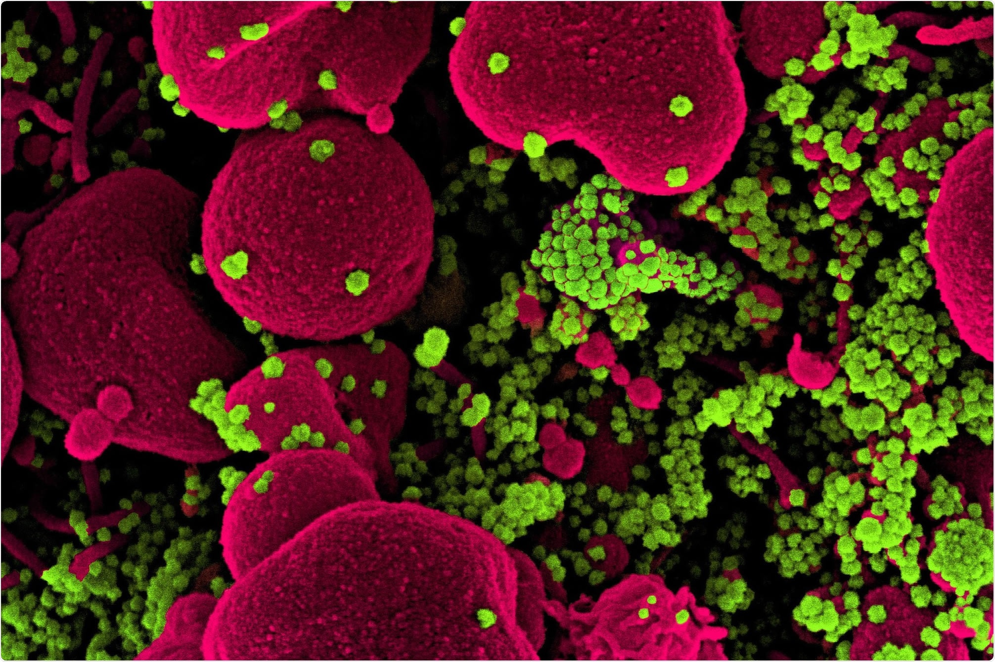 Study: Age-related heterogeneity in Neutralising antibody responses to SARS-CoV-2 following BNT162b2 vaccination. Image Credit: NIAID