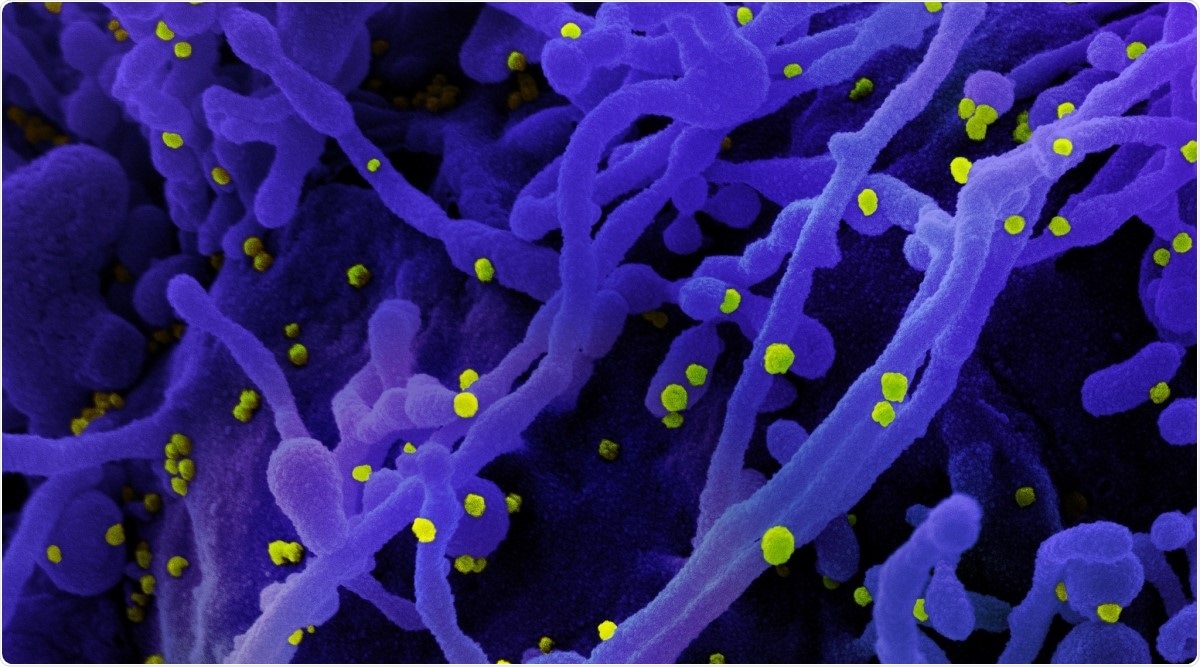 Study: Identification of anti-severe acute respiratory syndrome-related coronavirus 2 (SARS-CoV-2) oxysterol derivatives in vitro. Image Credit: NIAID / Flickr