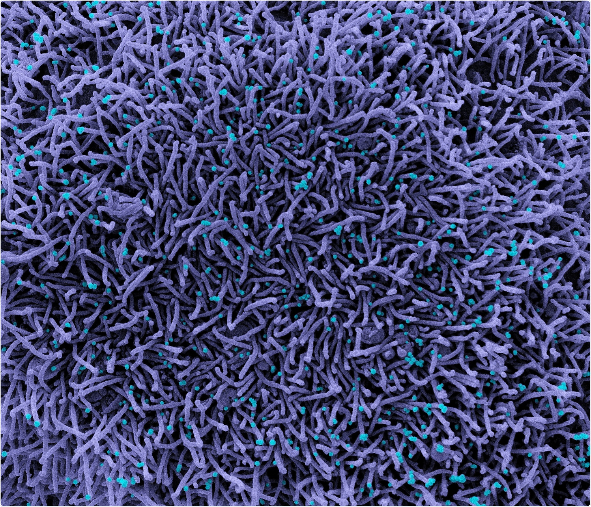 Study: Mapping of SARS-CoV-2 Brain Invasion and Histopathology in COVID-19 Disease. Image Credit: Credit: NIAID