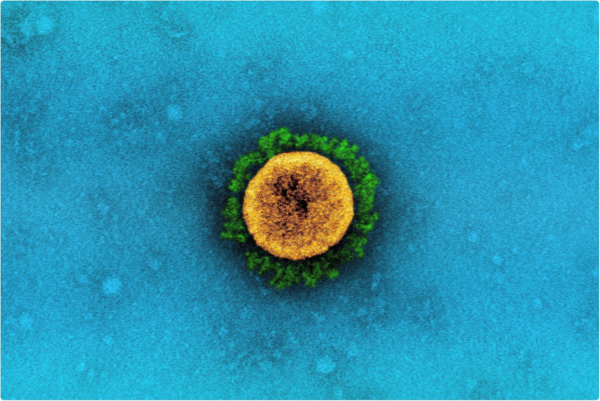 Study:. Comparative Perturbation-Based Modeling of the SARS-CoV-2 Spike Protein Binding with Host Receptor and Neutralizing Antibodies : Structurally Adaptable Allosteric Communication Hotspots Define Spike Sites Targeted by Global Circulating Mutations. Image Credit: NIAID