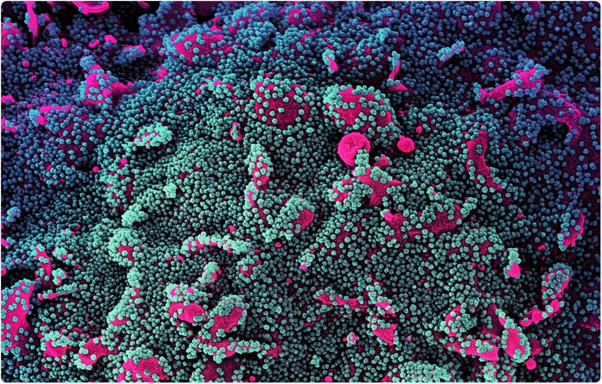 Study: REACT-1 round 9 final report: Continued but slowing decline of prevalence of SARS-CoV-2 during national lockdown in England in February 2021. Image Credit: NIAID