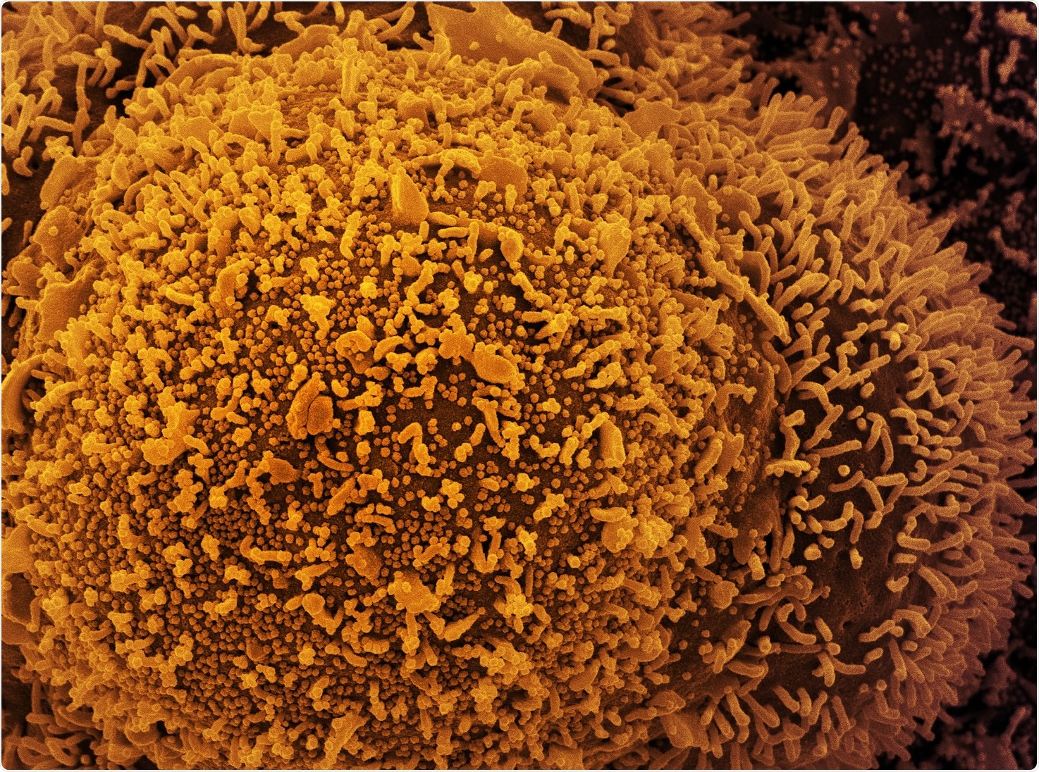 Study: Genetics of symptom remission in outpatients with COVID-19. Image Credit: NIAID