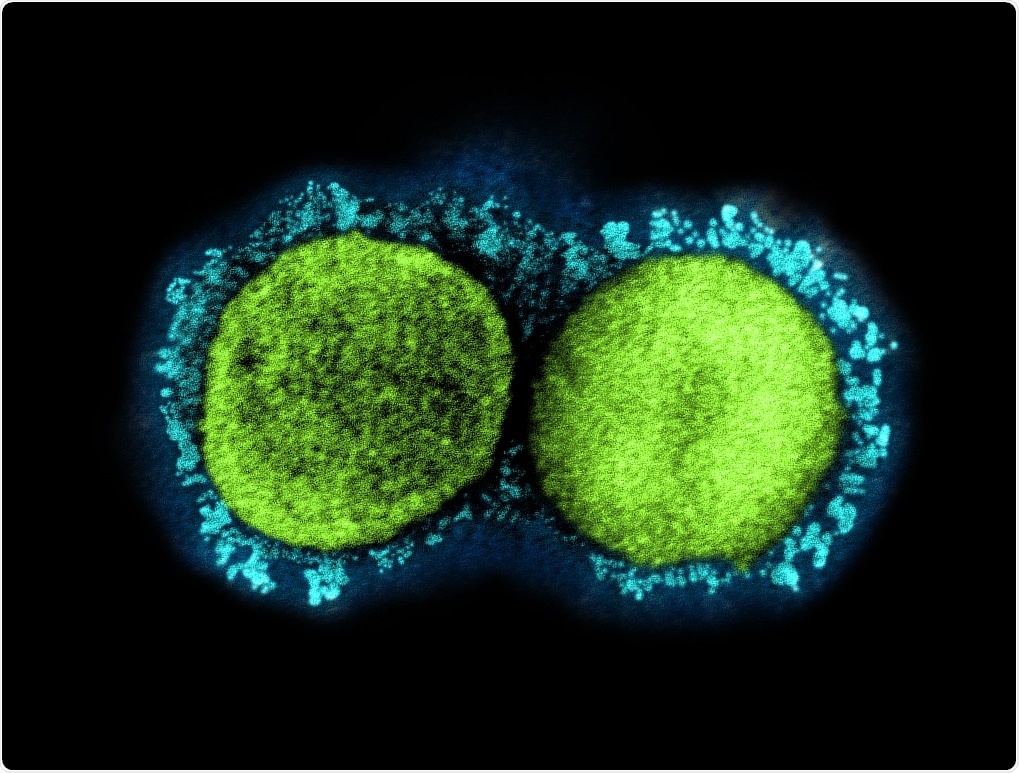 Study: S-acylation controls SARS-Cov-2 membrane lipid organization and enhances infectivity. Image Credit: NIAID