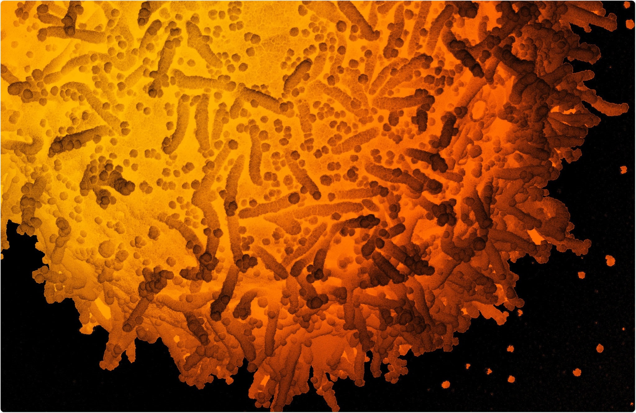Study: The N501Y spike substitution enhances SARS-CoV-2 transmission. Image Credit: NIAID