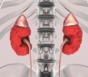 The pressure is on to diagnose and treat chronic kidney disease