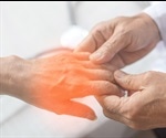 Peripheral Neuropathy Symptoms