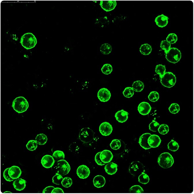 fluorescent antibodies