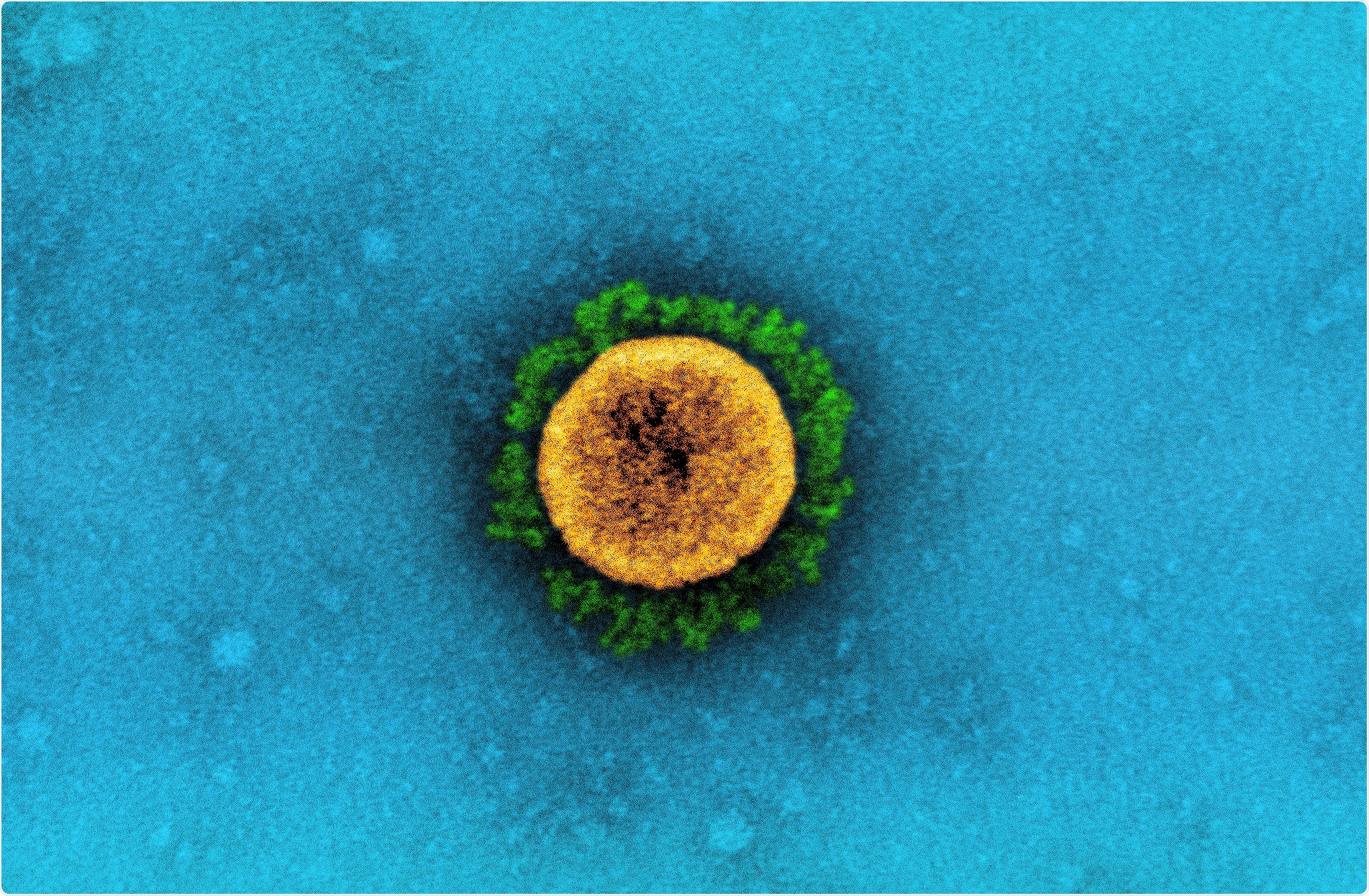 Study: Identifying SARS-CoV-2 Antiviral Compounds by Screening for Small Molecule Inhibitors of Nsp15 Endoribonuclease. Image Credit: NIAID
