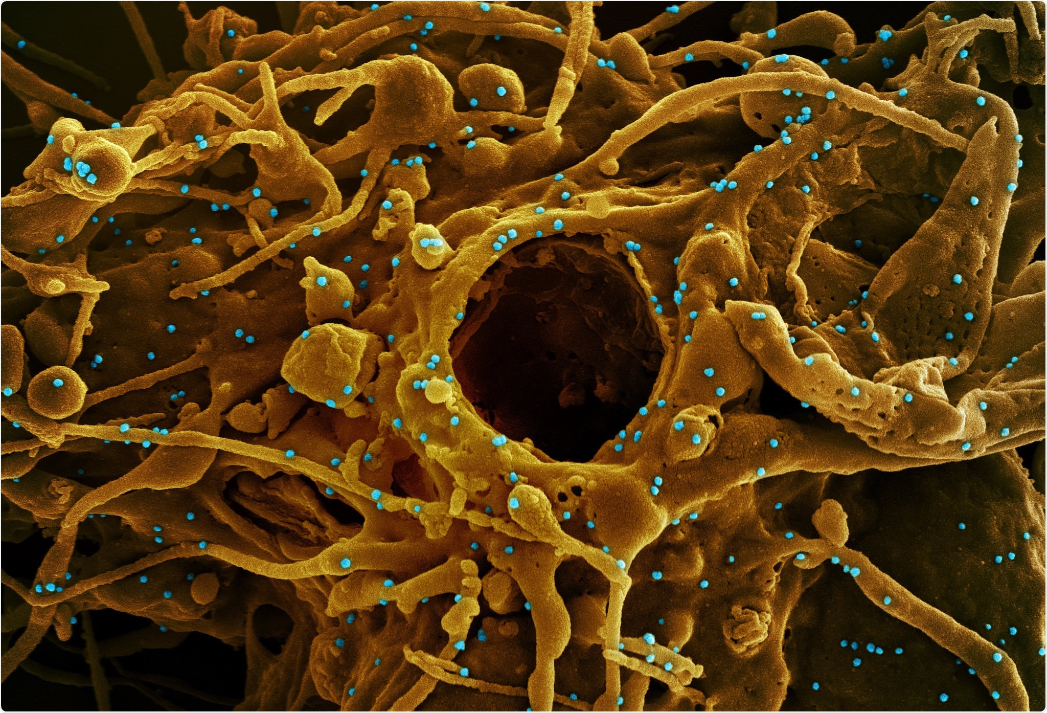 Study: One dose of COVID-19 nanoparticle vaccine REVC-128 provides protection against SARS-CoV-2 challenge at two weeks post immunization. Image Credit: NIAID