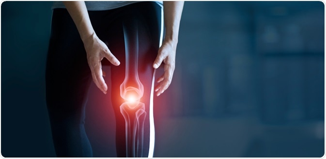 osteoarthritis