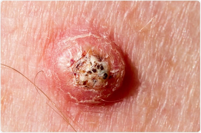 Image Credit: Peter Mullineux / Shutterstock