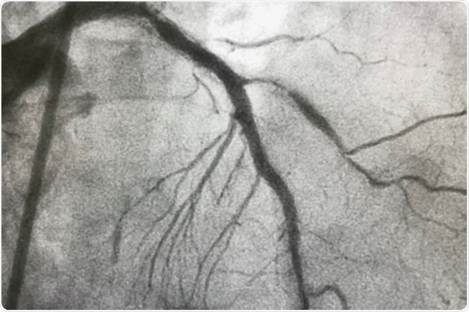 Image Credit: BelezaPoy / Shutterstock