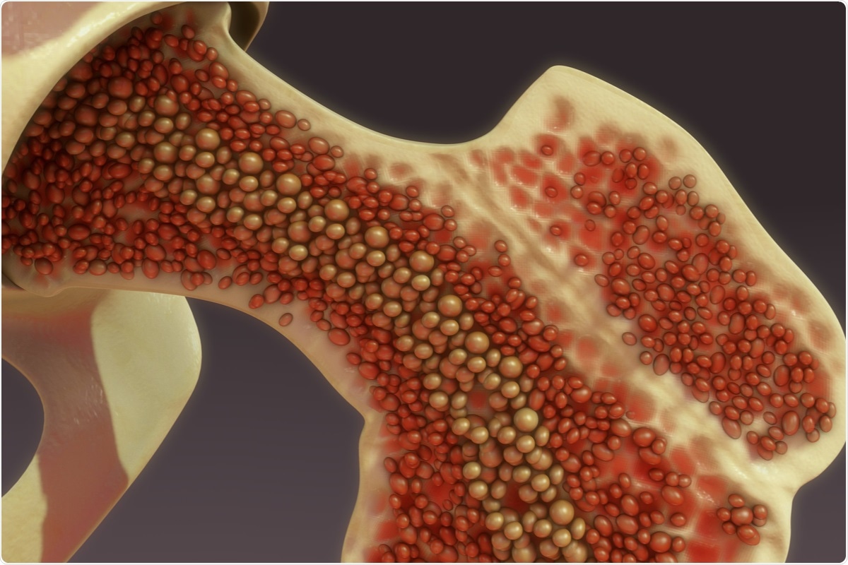 Study: Neuropilin-1 Mediates SARS-CoV-2 Infection in Bone Marrow-derived Macrophages. Image Credit: sciencepics / Shutterstock