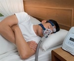 Obstructive Sleep Apnea Pathophysiology