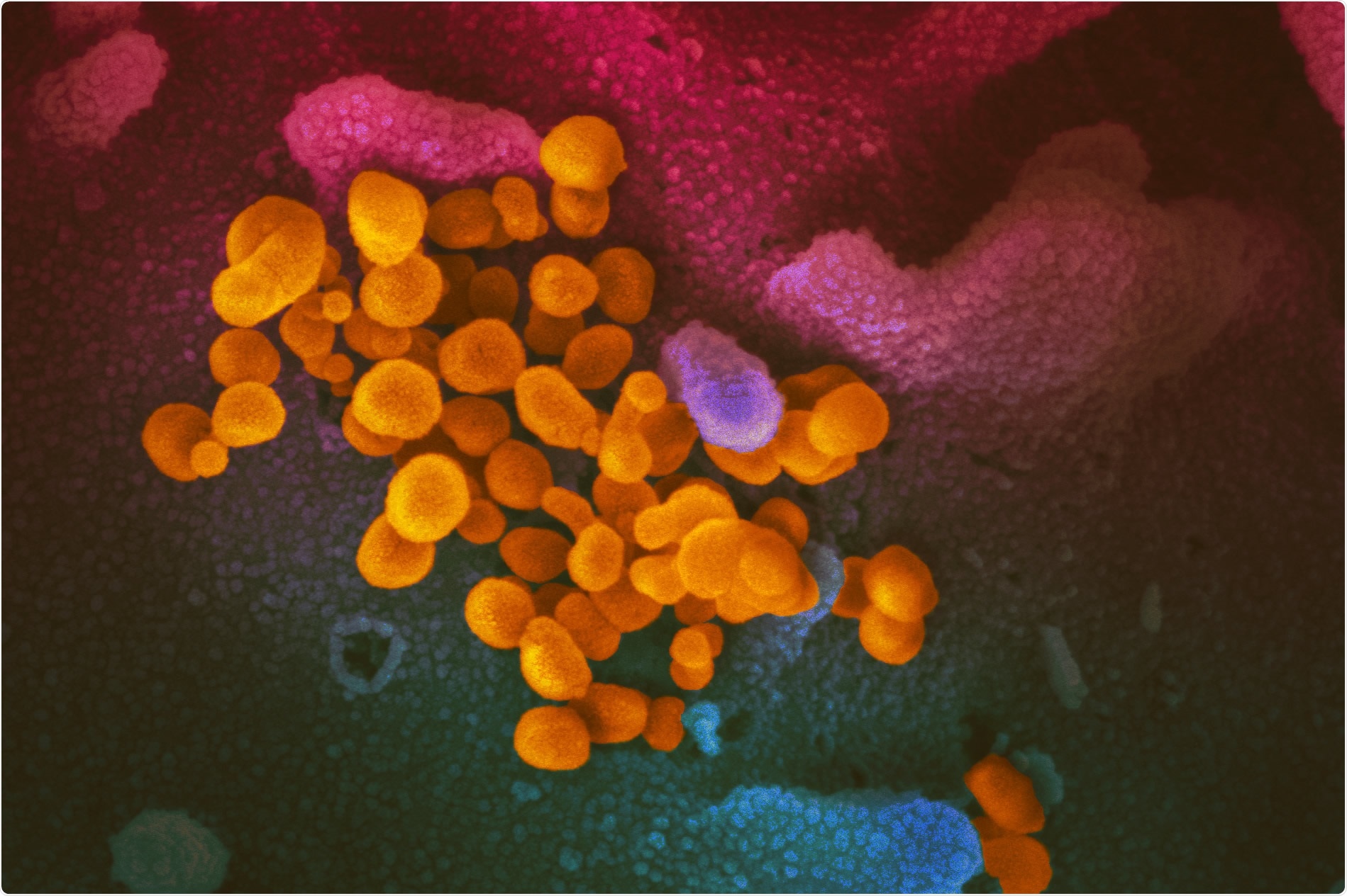 Study: Evaluation of mRNA-1273 against SARS-CoV-2 B.1.351 Infection in Nonhuman Primates Image Credit: NIAID