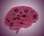 Preclinical study finds sex differences in neurological response to SARS-CoV-2 infection