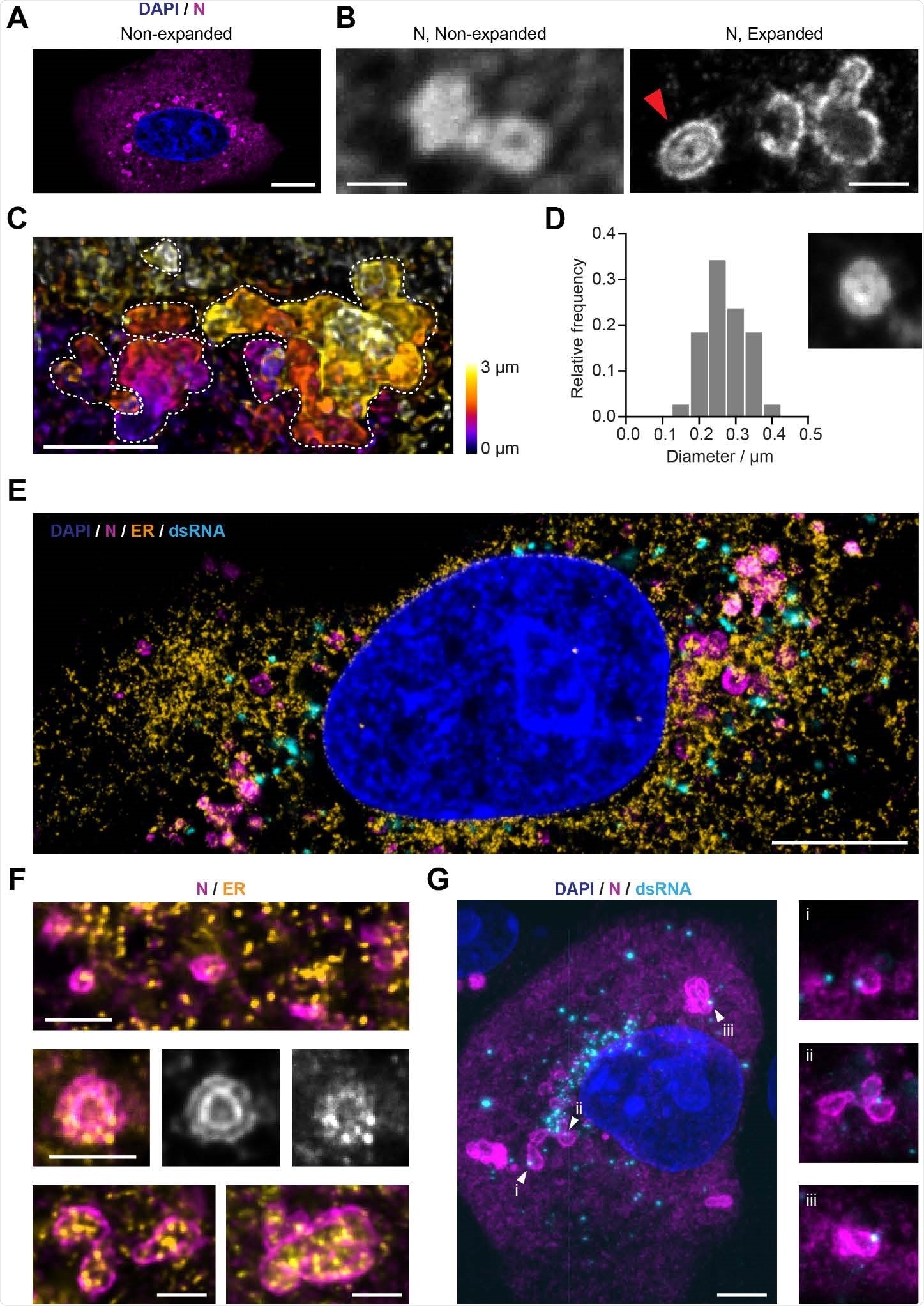 The SARS-CoV-2 nucleocapsid (N) protein is organised in layered structures that host RNA replication foci and are strongly interwoven with the topology of the endoplasmic reticulum. A) Confocal microscopy shows that the nucleocapsid protein forms punctate patterns in the cytosol of infected Vero cells (Blue: nuclei; magenta: nucleocapsid protein). Scale bar 10 μm. The numbers of puncta per cell and size increase in a stage-dependent manner (Supporting Figure 6). B) A combination of expansion and confocal microscopy shows that some of the larger nucleocapsid protein structures observed at later time points (from 10 hpi on) consist of double layers (red arrow). Scale bars 1 μm (taking into account a linear expansion factor of 4.2). C) A combination of expansion and light sheet microscopy reveals convoluted nucleocapsid protein structures, here shown as maximum intensity projections. Each dotted line outlines the boundaries of each convoluted nucleocapsid protein structure. Scale bar 2 μm (taking into account an expansion factor of 4.2). D) Size distribution analysis of the nucleocapsid protein double-layer compartments recorded 12 hours post-infection. The inner circular layer has an average diameter of 275 nm. 38 compartments from 10 cells were analysed. Size of the micrograph is 1.25 μm per side. E) Representative image of an expanded Vero cell stained for the nucleus (blue), ER (calnexin protein, orange), nucleocapsid protein (magenta) and dsRNA (cyan), imaged on a confocal microscope. Scale bar 5 μm (taking into account an expansion factor of 4.2). F) Details of the nucleocapsid protein (magenta) and the ER (yellow), showing that the nucleocapsid protein forms layers around ER membranes. This indicates that the nucleocapsid protein structures might be localised at double membrane vesicles (DMVs) or packets of DMVs. Scale bars 1 μm (taking into account an expansion factor of 4.2). G) A combination of expansion and light sheet microscopy reveals the interaction between dsRNA (cyan) and the nucleocapsid protein N (magenta). This shows that dsRNA foci sit in the layers of the N compartments. Scale bar 5 μm (taking into account an expansion factor of 4.2). Size of the smaller micrographs is 5 μm per side.