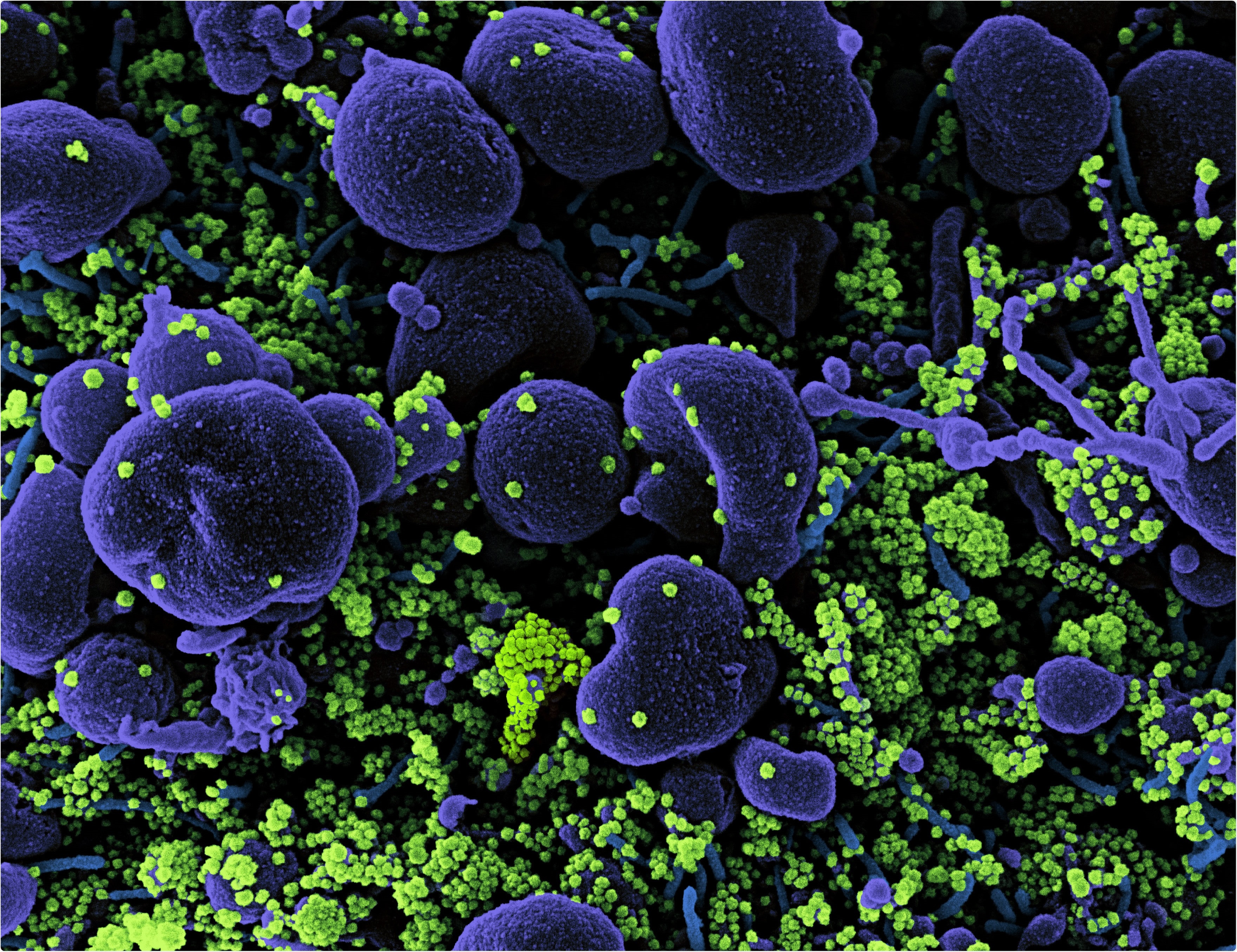 Review: SARS-CoV-2: Unique Challenges of the Virus and Vaccines. Image Credit: NIAID