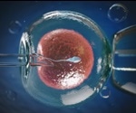 Higher risk of preeclampsia and pregnancy-induced hypertension as a result of embryo freezing for IVF