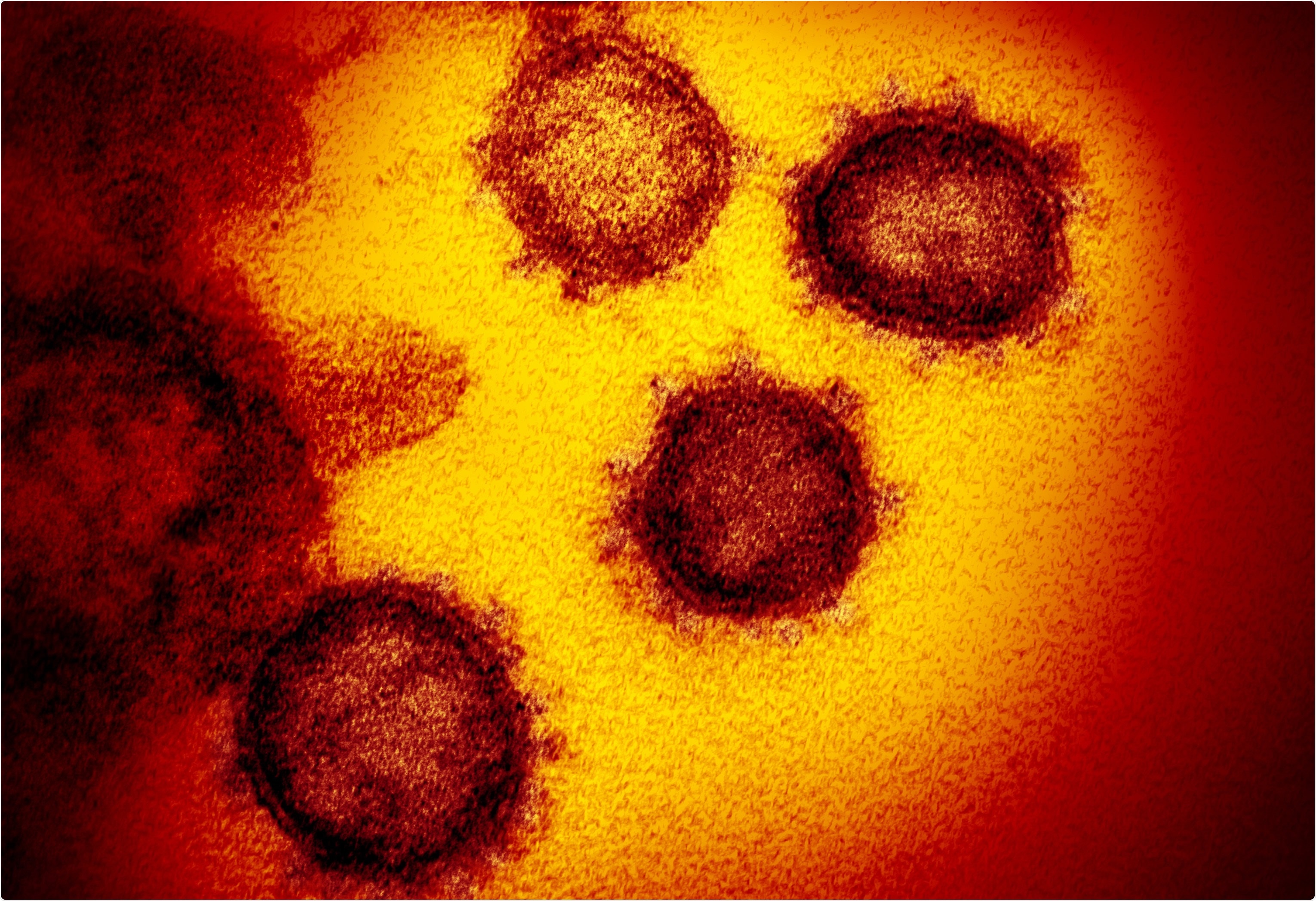 Study: SARS-CoV-2 B.1.617 mutations L452 and E484Q are not synergistic for antibody evasion. Image Credit: NIAID